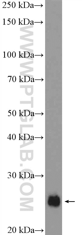 WB analysis of HeLa using 10825-1-AP