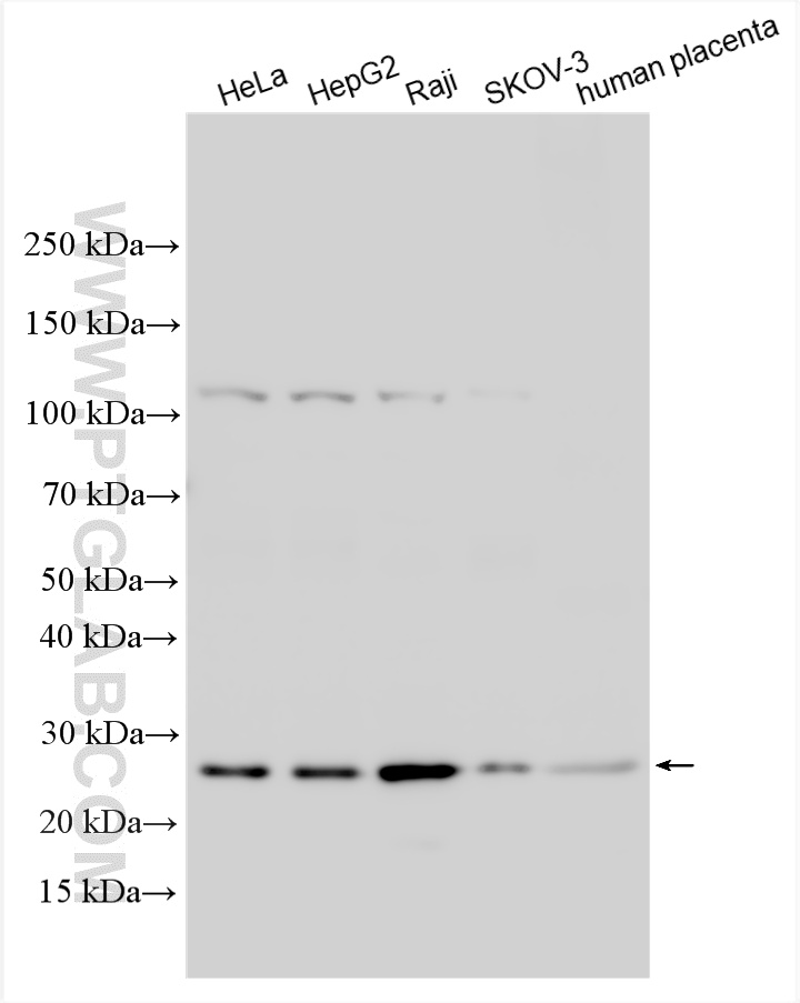 WB analysis using 10825-1-AP WB analysis using 10825-1-AP