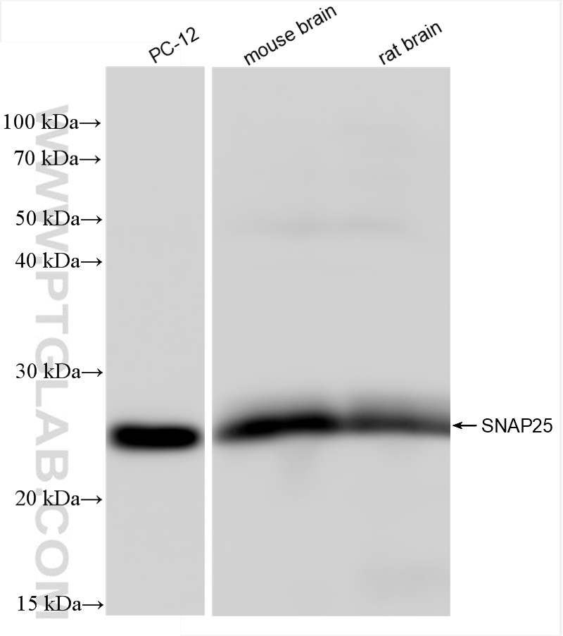 WB analysis using 83259-5-RR (same clone as 83259-5-PBS)