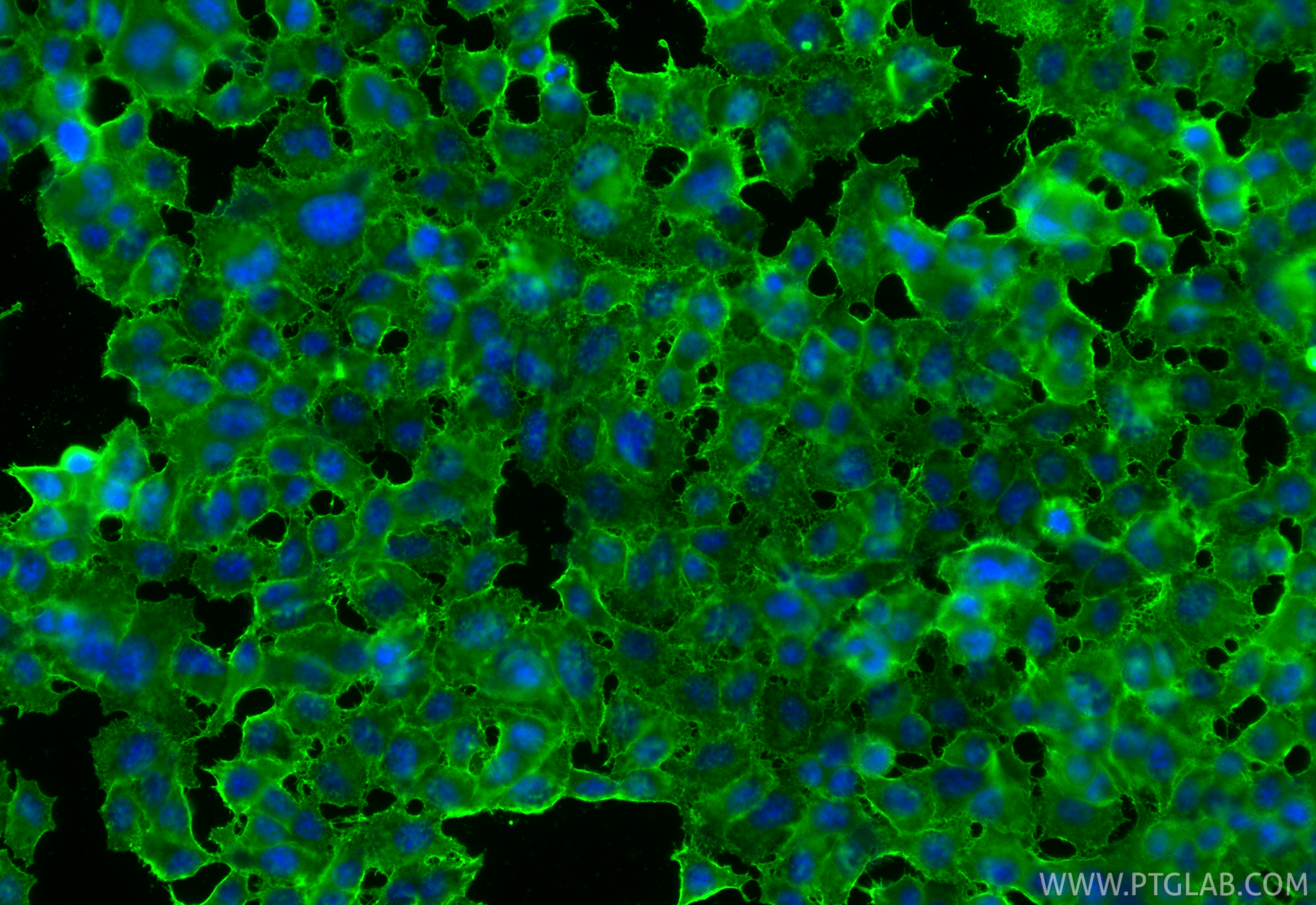 IF Staining of PC-12 using RMX00106 IF Staining of PC-12 using RMX00106