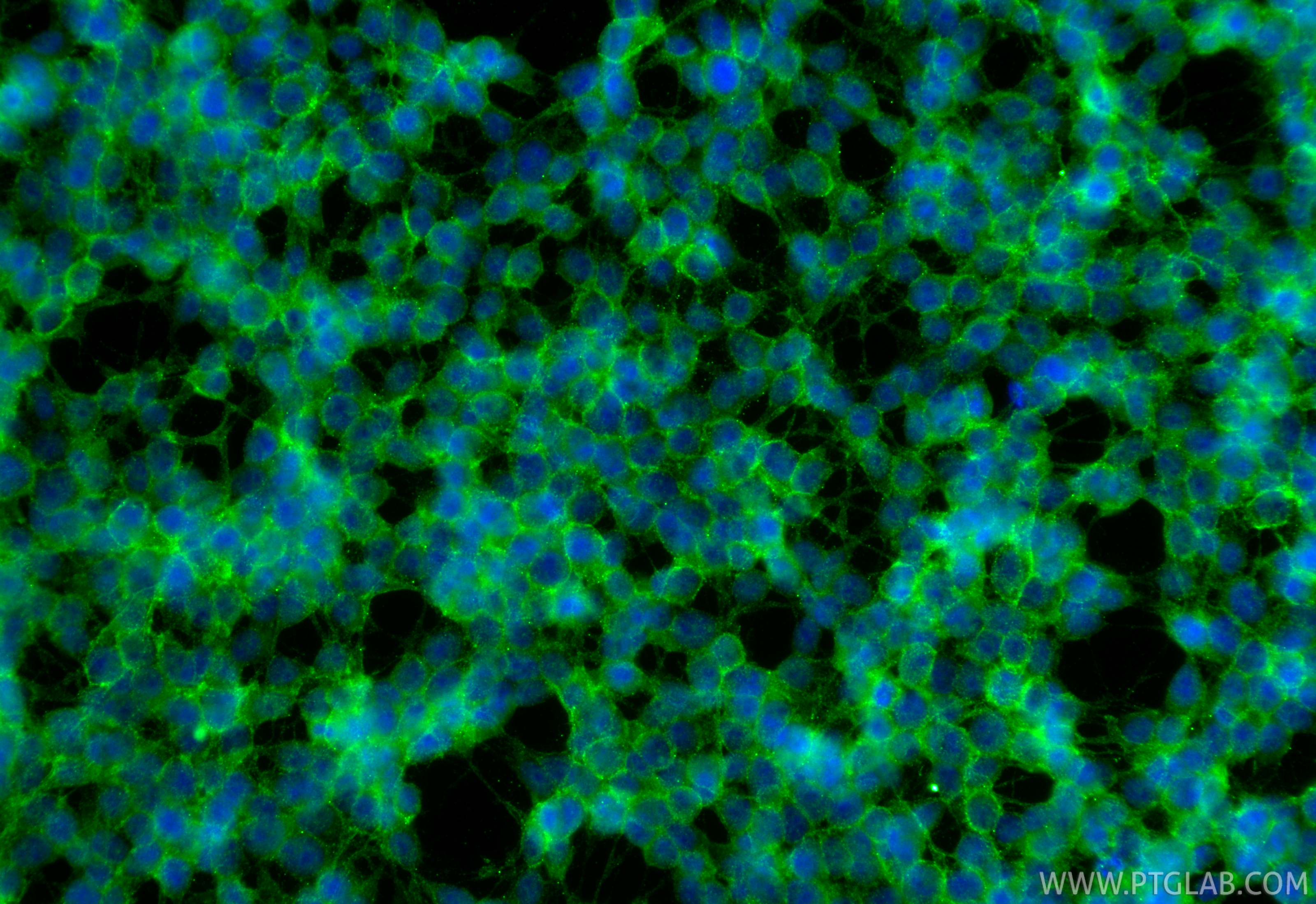 IF Staining of SH-SY5Y using RMX00106 IF Staining of SH-SY5Y using RMX00106