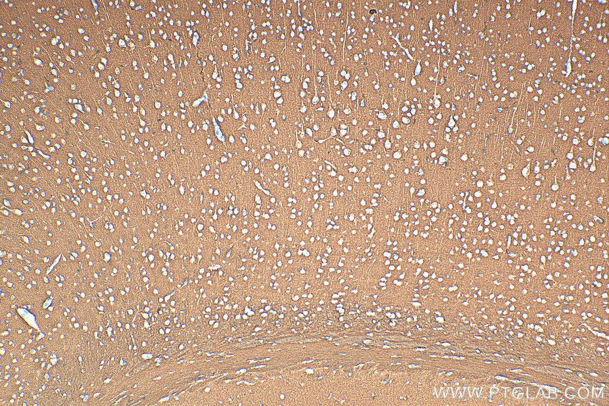 IHC staining of mouse brain using RMX00106 IHC staining of mouse brain using RMX00106