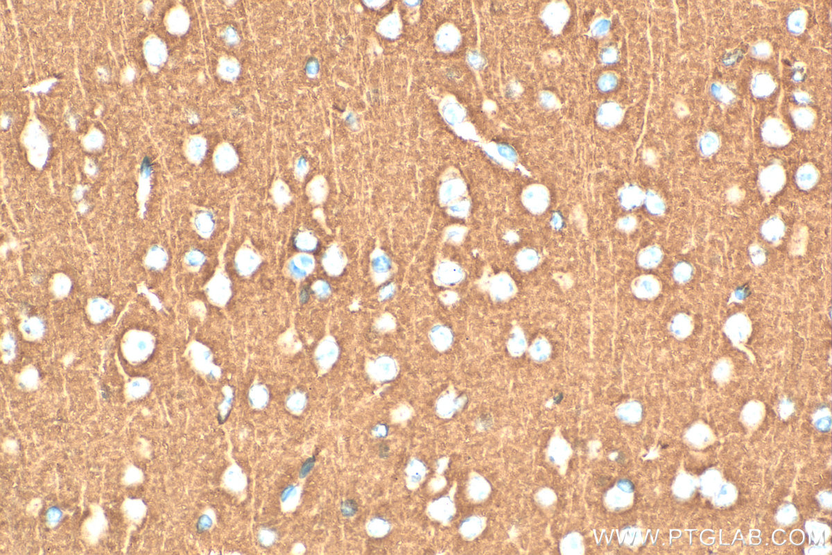 IHC staining of mouse brain using RMX00106 IHC staining of mouse brain using RMX00106
