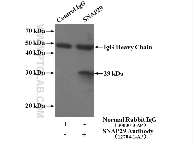 IP experiment of Jurkat using 12704-1-AP