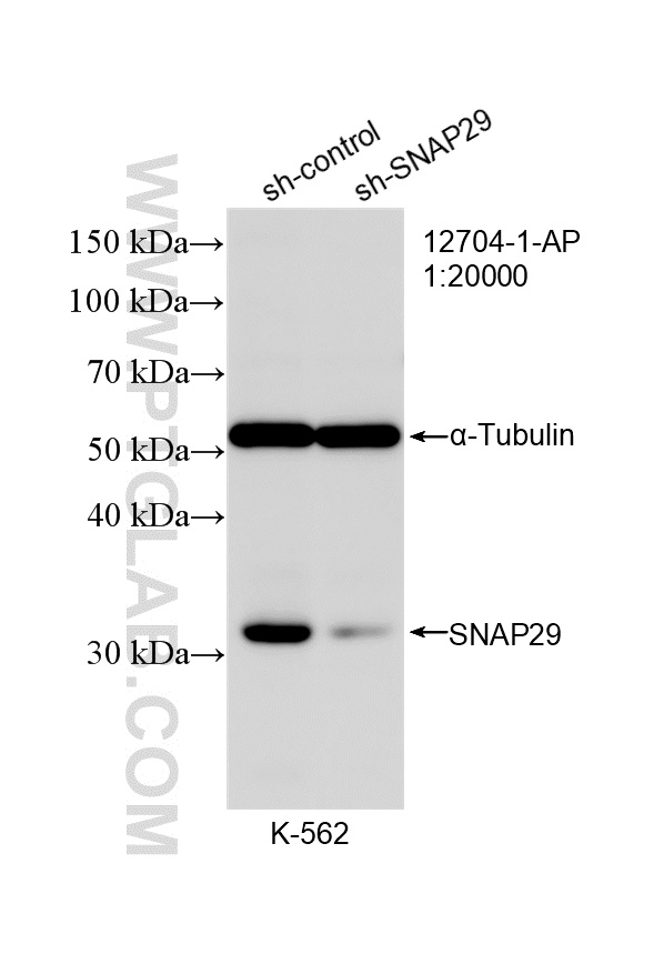 WB analysis of K-562 using 12704-1-AP
