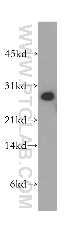 WB analysis of human kidney using 12704-1-AP