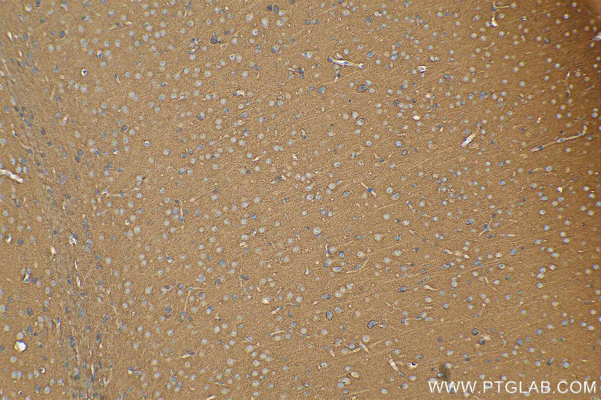IHC staining of mouse brain using 14093-1-AP