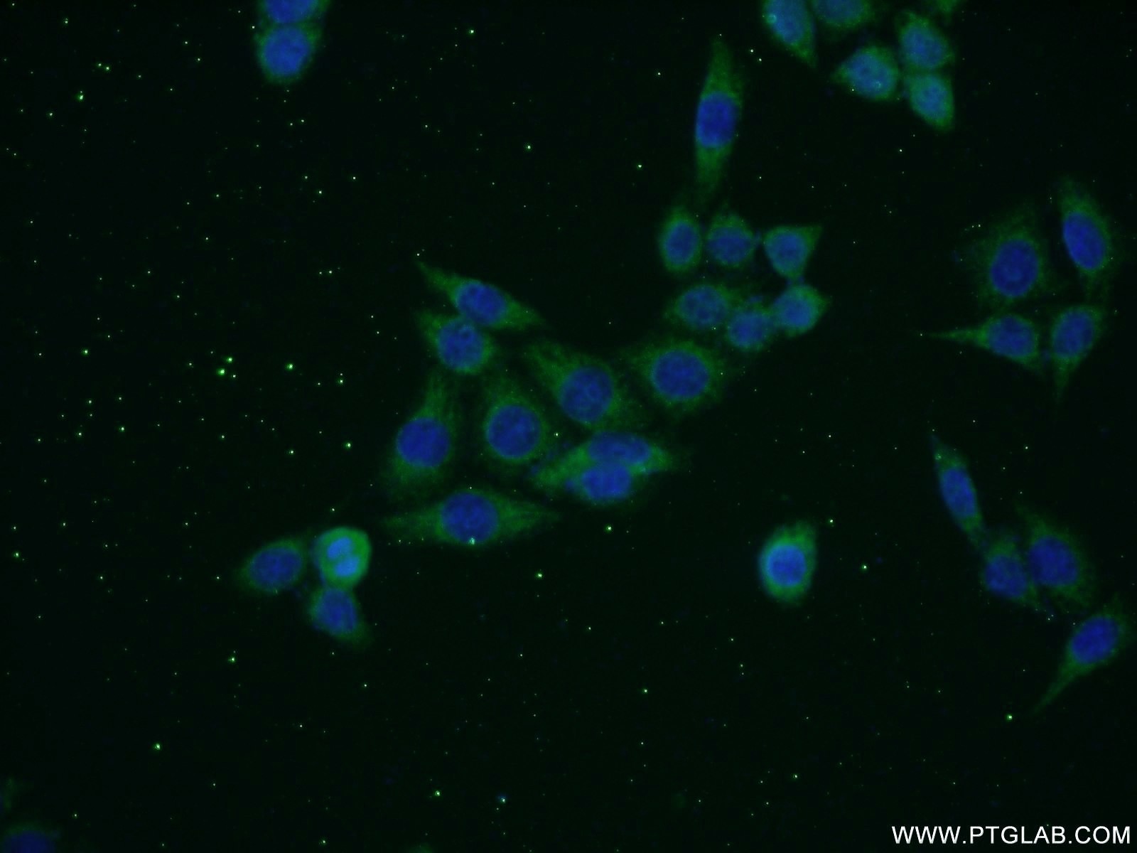 IF Staining of HeLa using 17272-1-AP