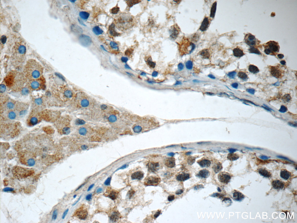 IHC staining of human testis using 17272-1-AP