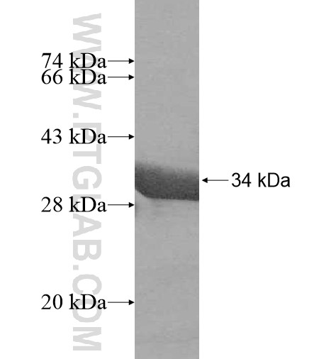 SNAPC5 fusion protein Ag11029 SDS-PAGE