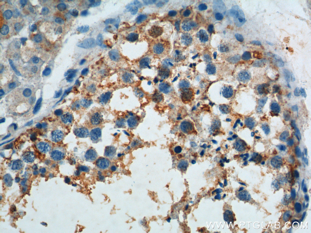 IHC staining of human testis using 10055-1-AP