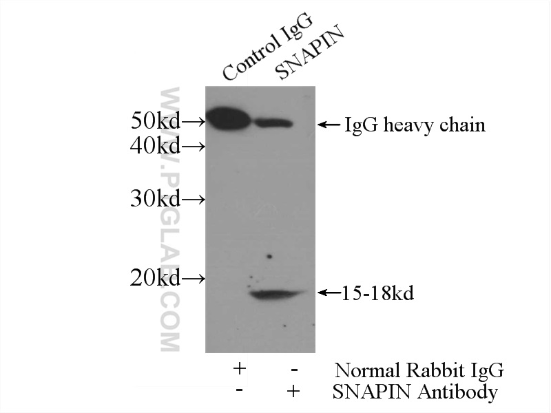 IP experiment of mouse brain using 10055-1-AP