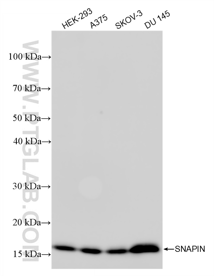 WB analysis using 85949-1-RR (same clone as 85949-1-PBS)