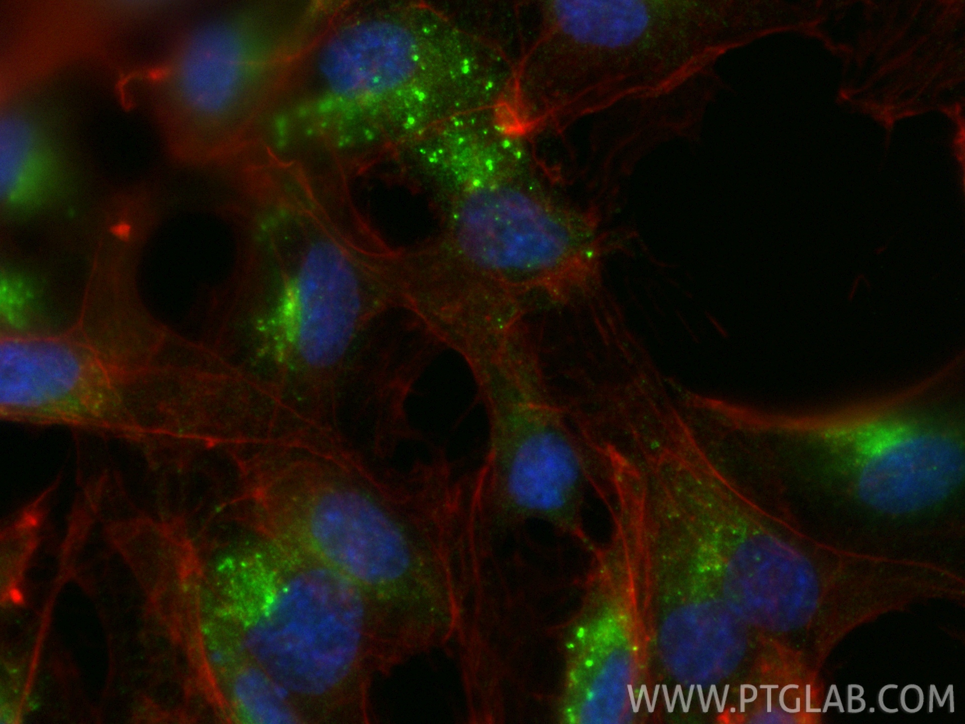 IF Staining of HUVEC using 25928-1-AP