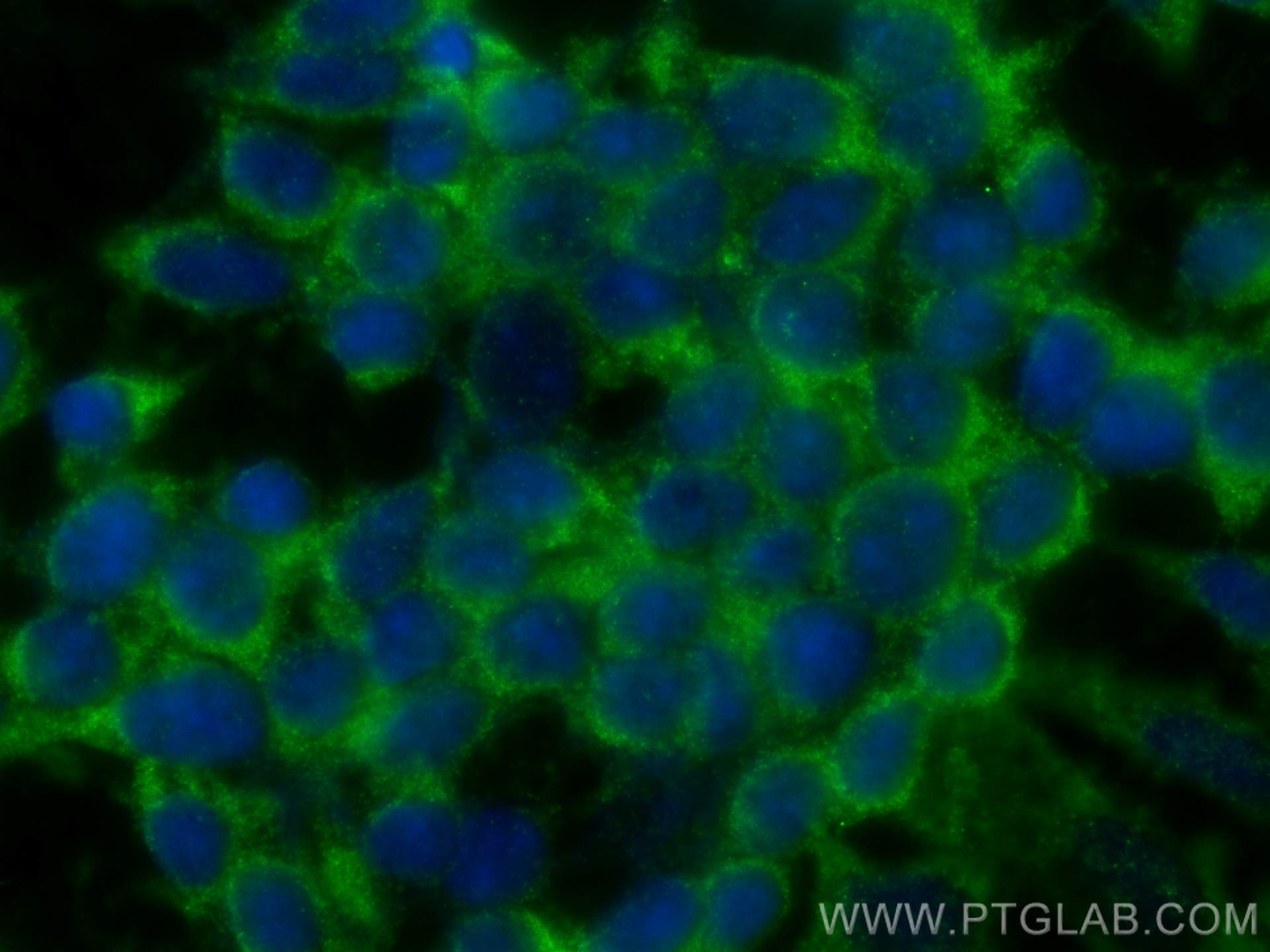 IF Staining of SH-SY5Y using 10842-1-AP