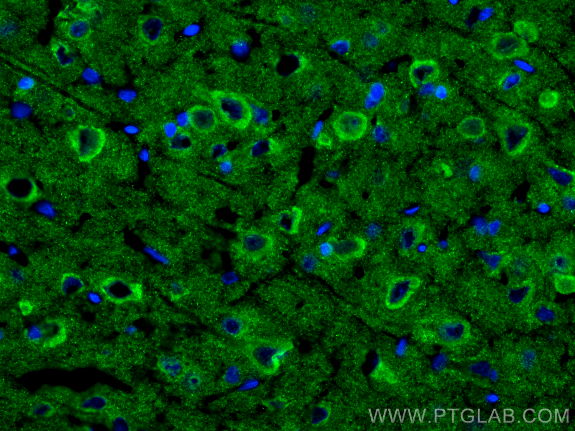 IF Staining of rat brain using 10842-1-AP