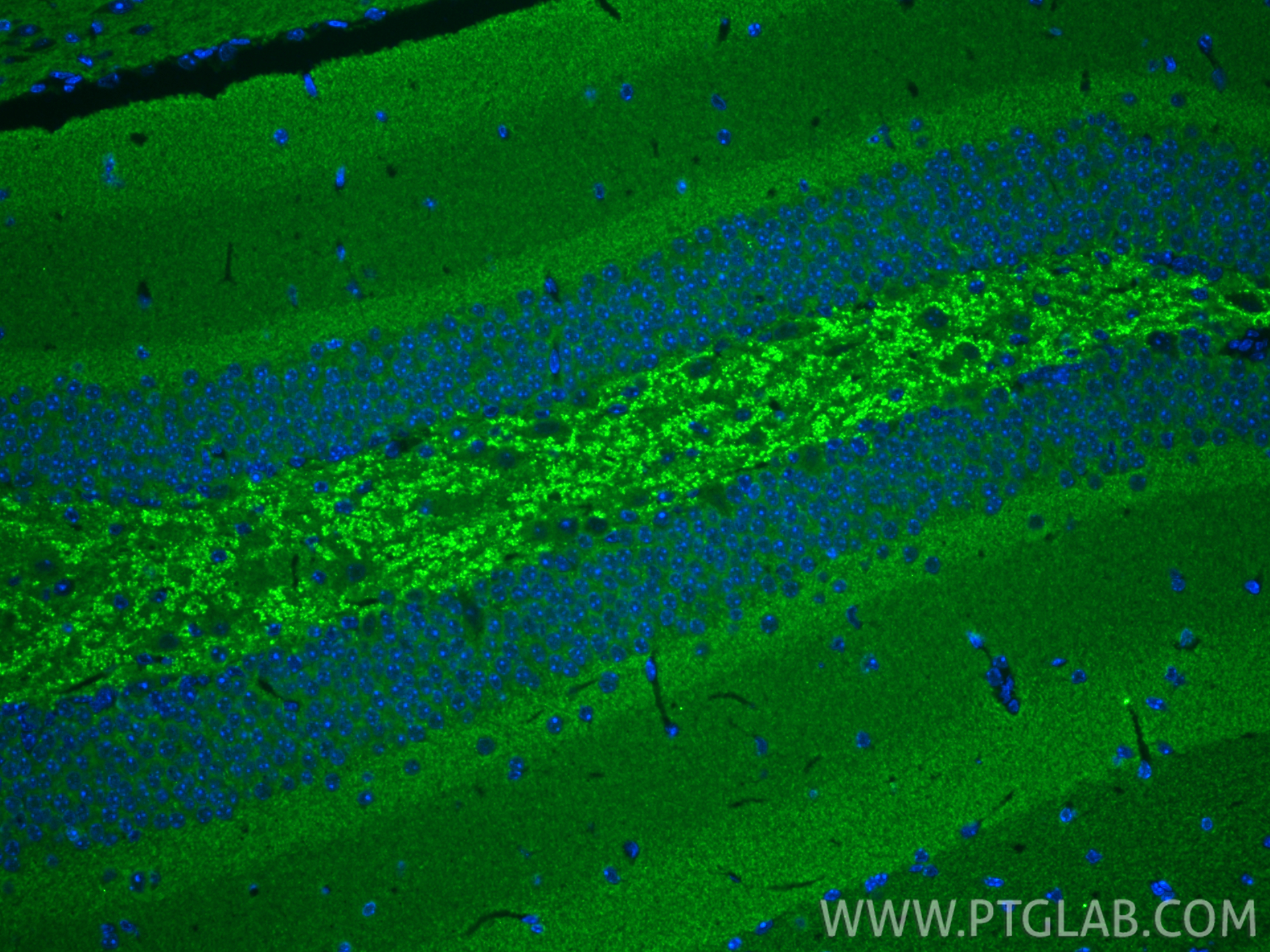IF Staining of mouse brain using 10842-1-AP IF Staining of mouse brain using 10842-1-AP