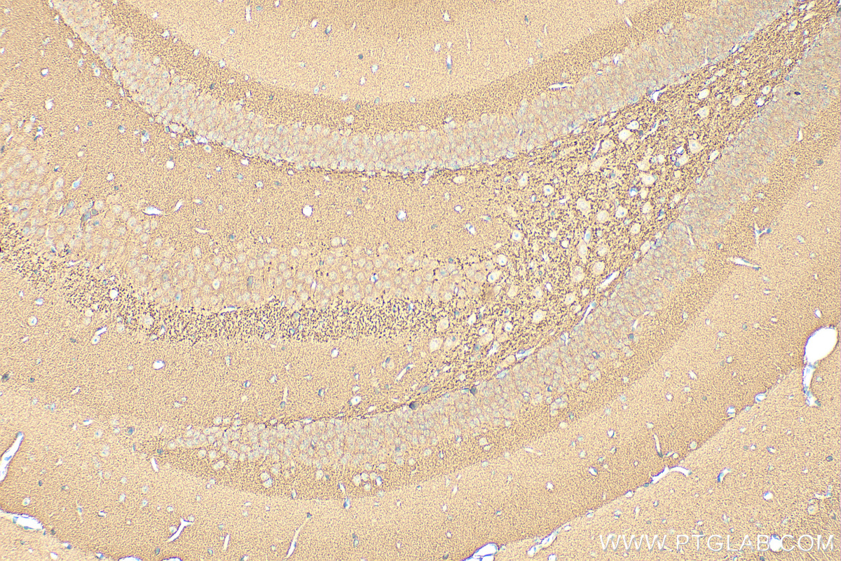 IHC staining of mouse brain using 10842-1-AP