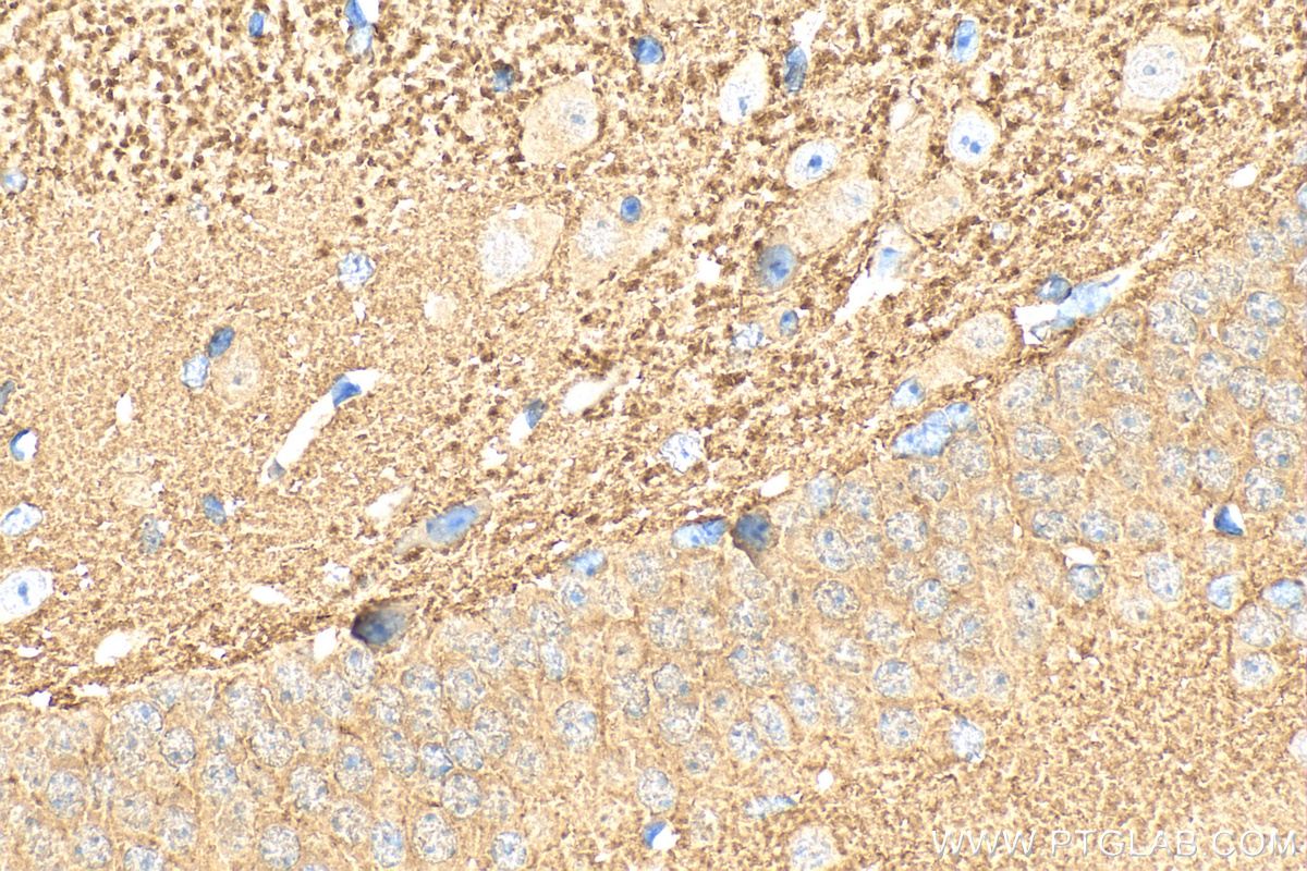 IHC staining of mouse brain using 10842-1-AP