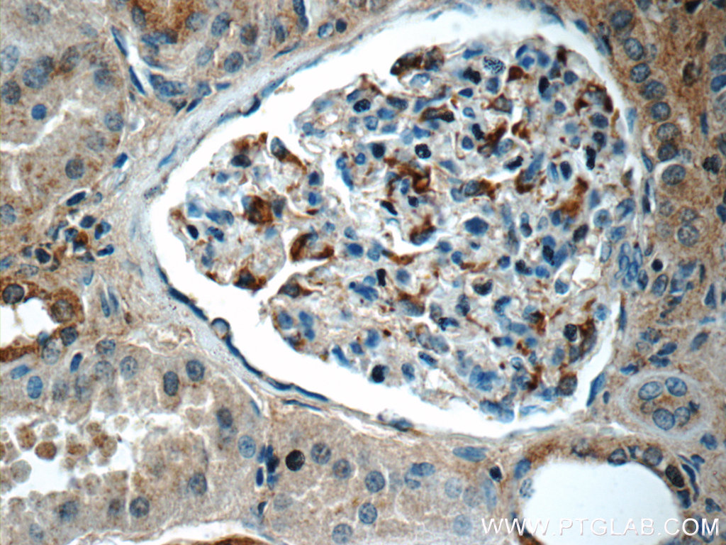 IHC staining of human kidney using 17818-1-AP