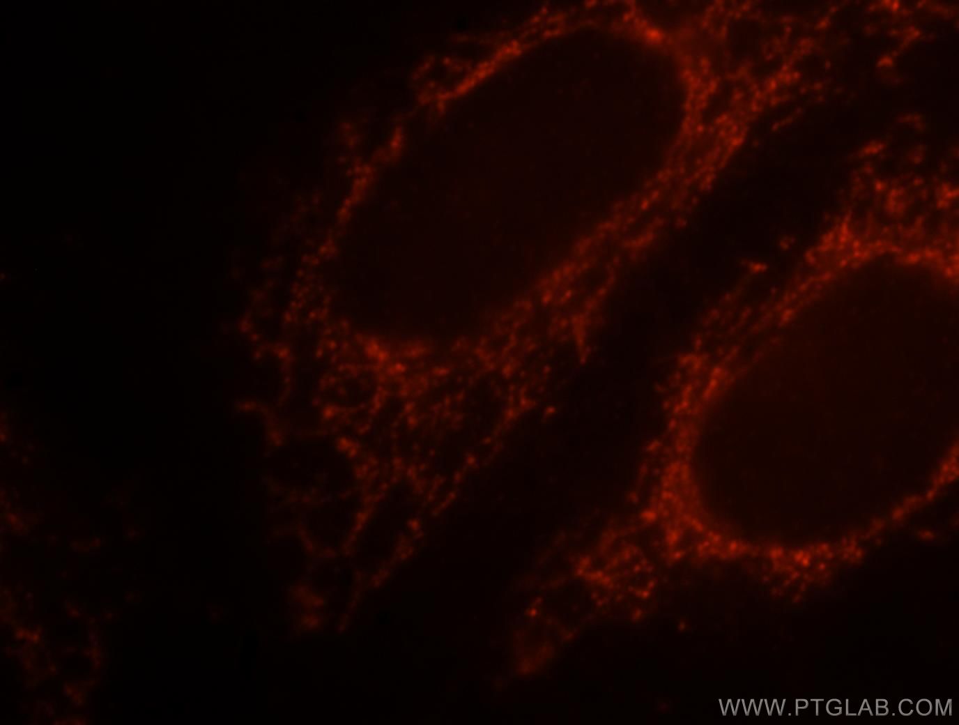 IF Staining of HepG2 using 10498-1-AP