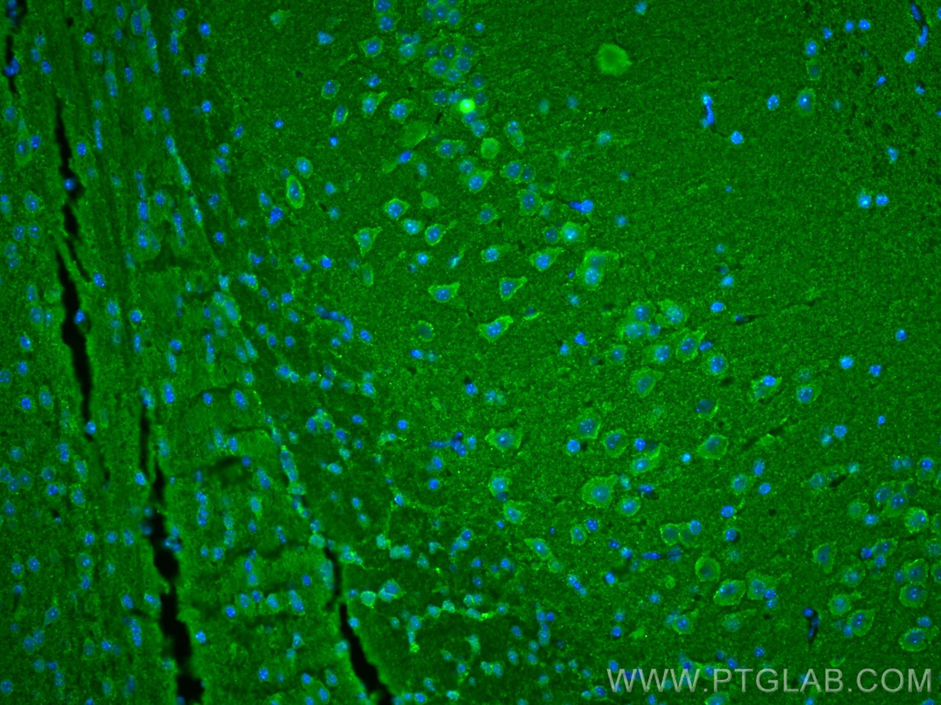 IF Staining of mouse brain using 68046-1-Ig (same clone as 68046-1-PBS)