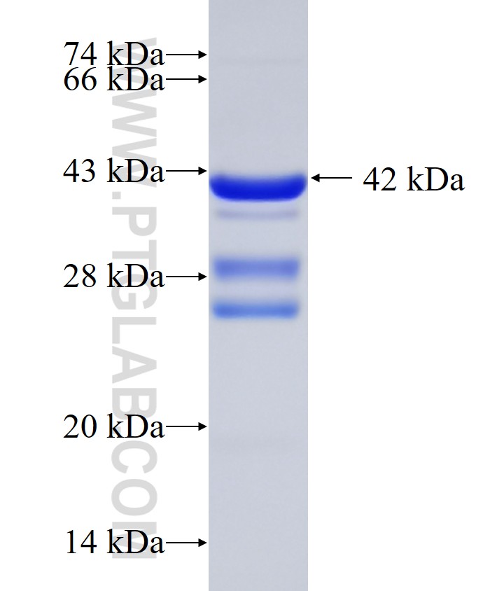 SNCB fusion protein Ag0772 SDS-PAGE