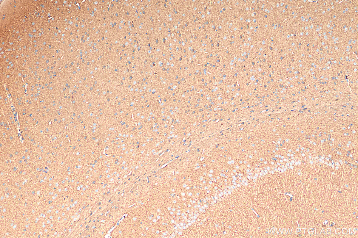 IHC staining of mouse brain using 16398-1-AP