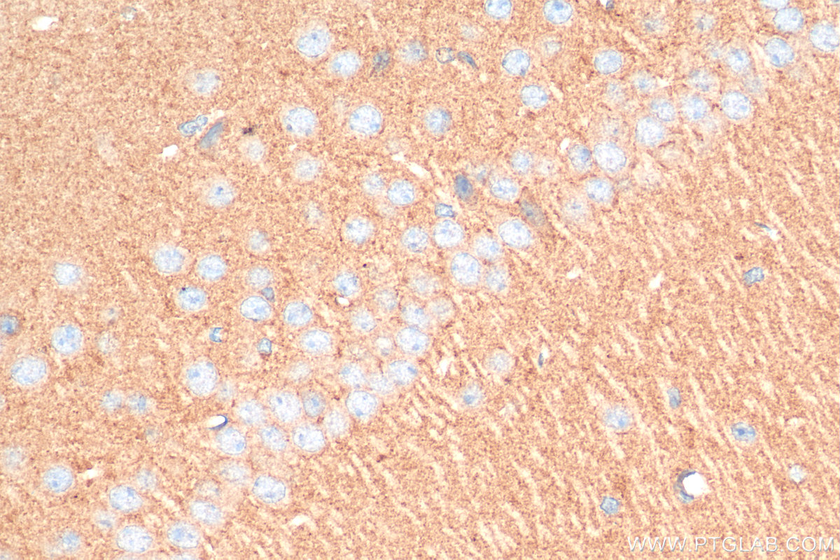 IHC staining of mouse brain using 16398-1-AP