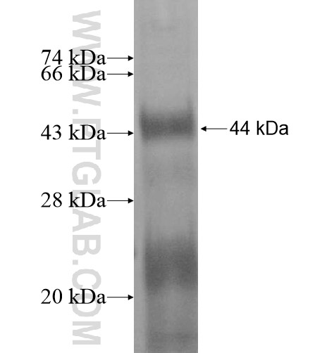 SNED1 fusion protein Ag15417 SDS-PAGE SNED1 fusion protein Ag15417 SDS-PAGE