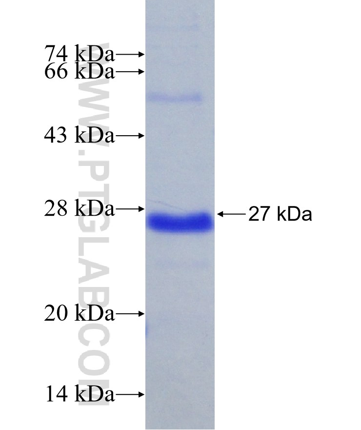 SNF2L fusion protein Ag31016 SDS-PAGE