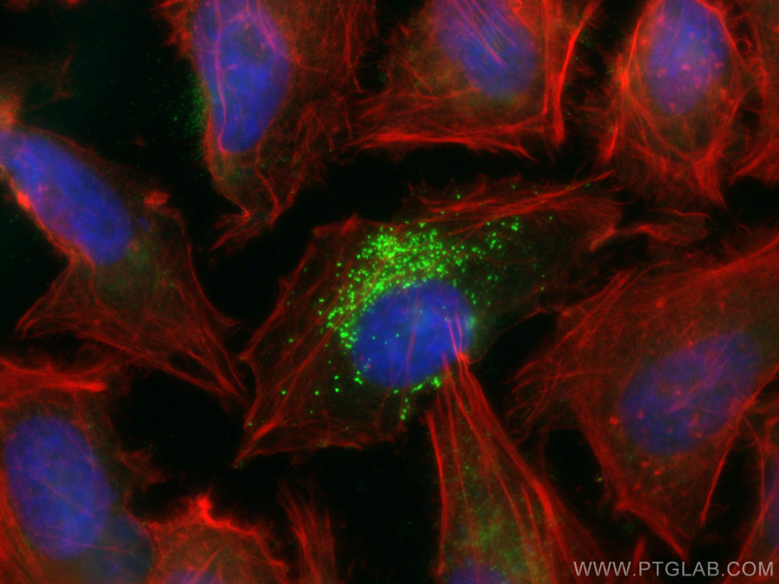 IF Staining of HeLa using 67696-1-Ig (same clone as 67696-1-PBS)