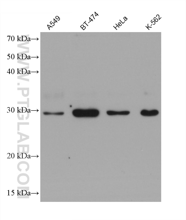 WB analysis using 67696-1-Ig