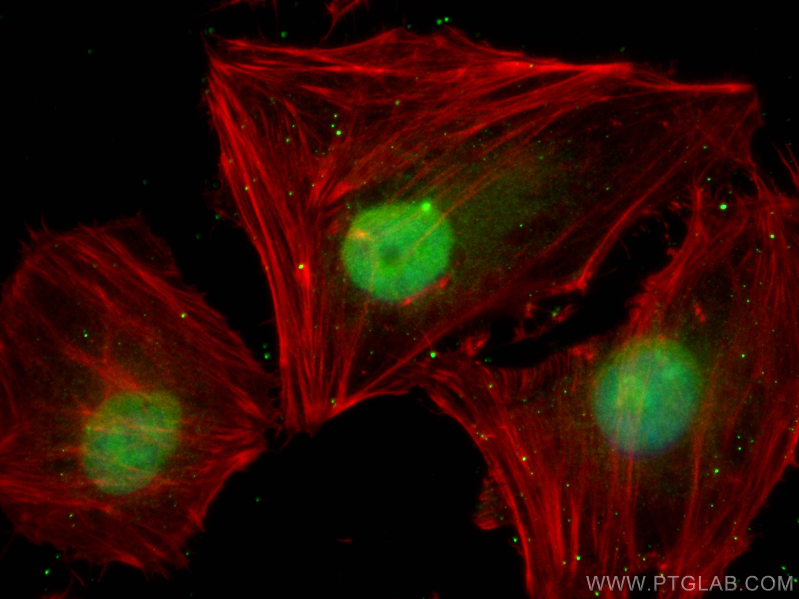 IF Staining of HeLa using 14950-1-AP