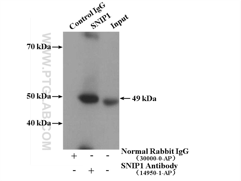 IP experiment of HeLa using 14950-1-AP