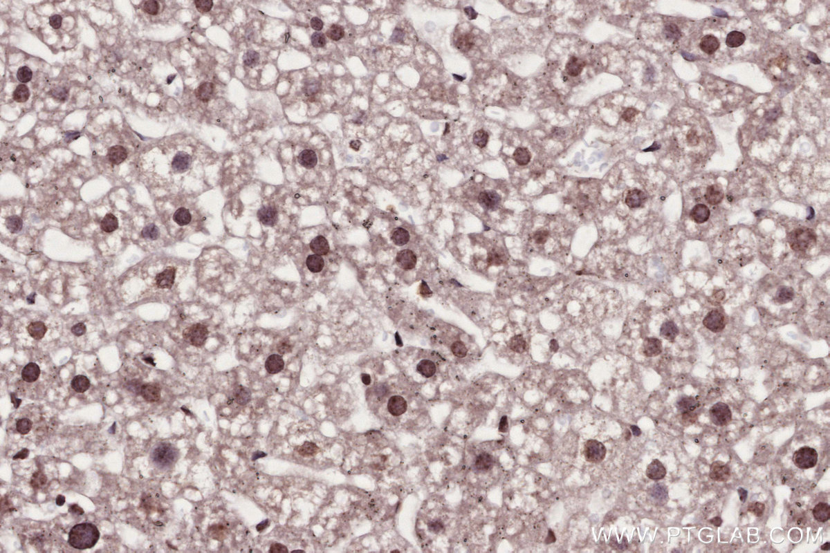 IHC staining of mouse liver using 82962-1-RR