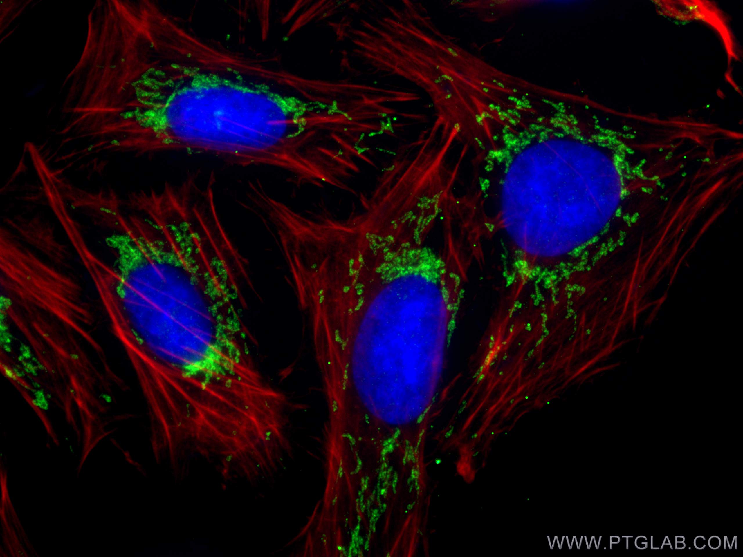 IF Staining of U2OS using 13914-1-AP