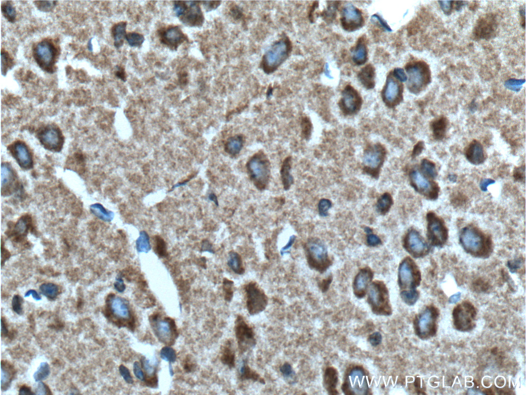 IHC staining of mouse brain using 13646-1-AP