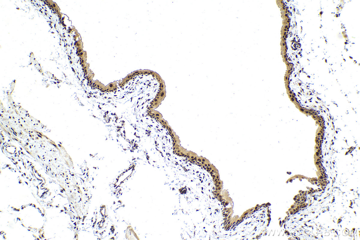 IHC staining of mouse bladder using 23875-1-AP