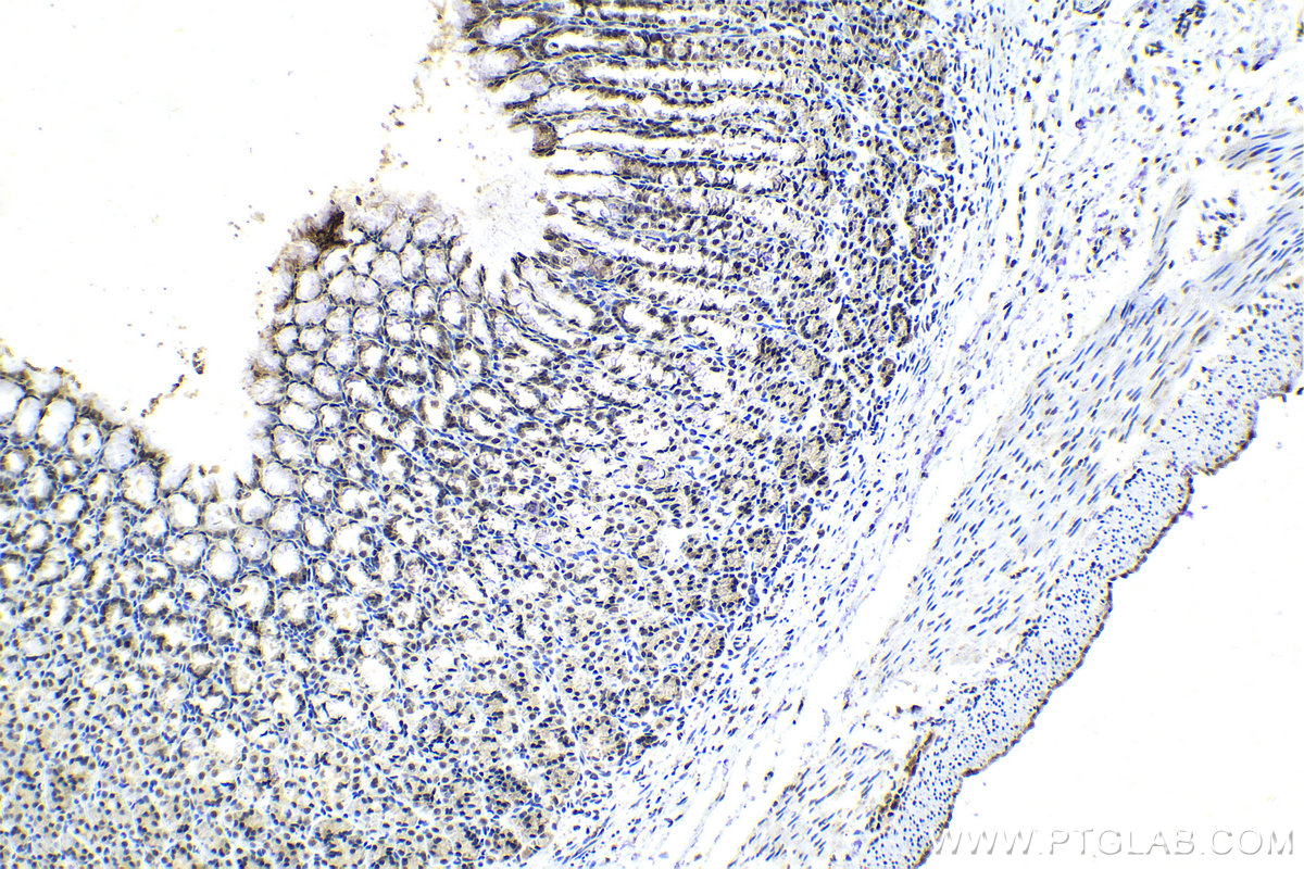 IHC staining of rat stomach using 23875-1-AP