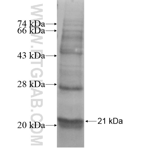 SNRNP25 fusion protein Ag13781 SDS-PAGE SNRNP25 fusion protein Ag13781 SDS-PAGE