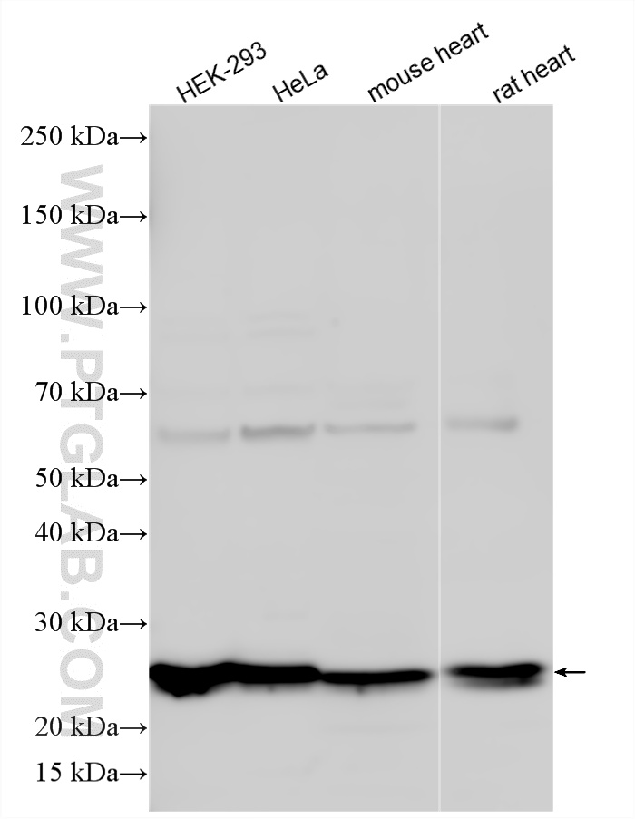 WB analysis using 20505-1-AP (same clone as 20505-1-PBS) WB analysis using 20505-1-AP (same clone as 20505-1-PBS)
