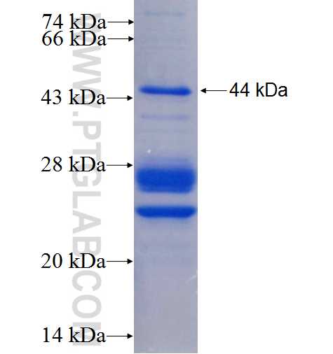 SNRNP70 fusion protein Ag24776 SDS-PAGE