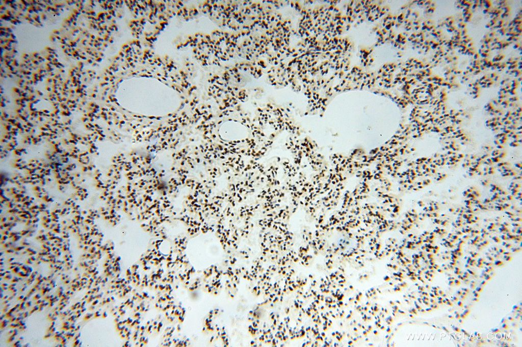 IHC staining of human lung using 17368-1-AP