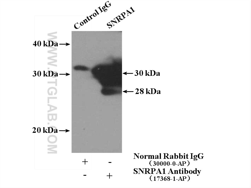 IP experiment of HepG2 using 17368-1-AP