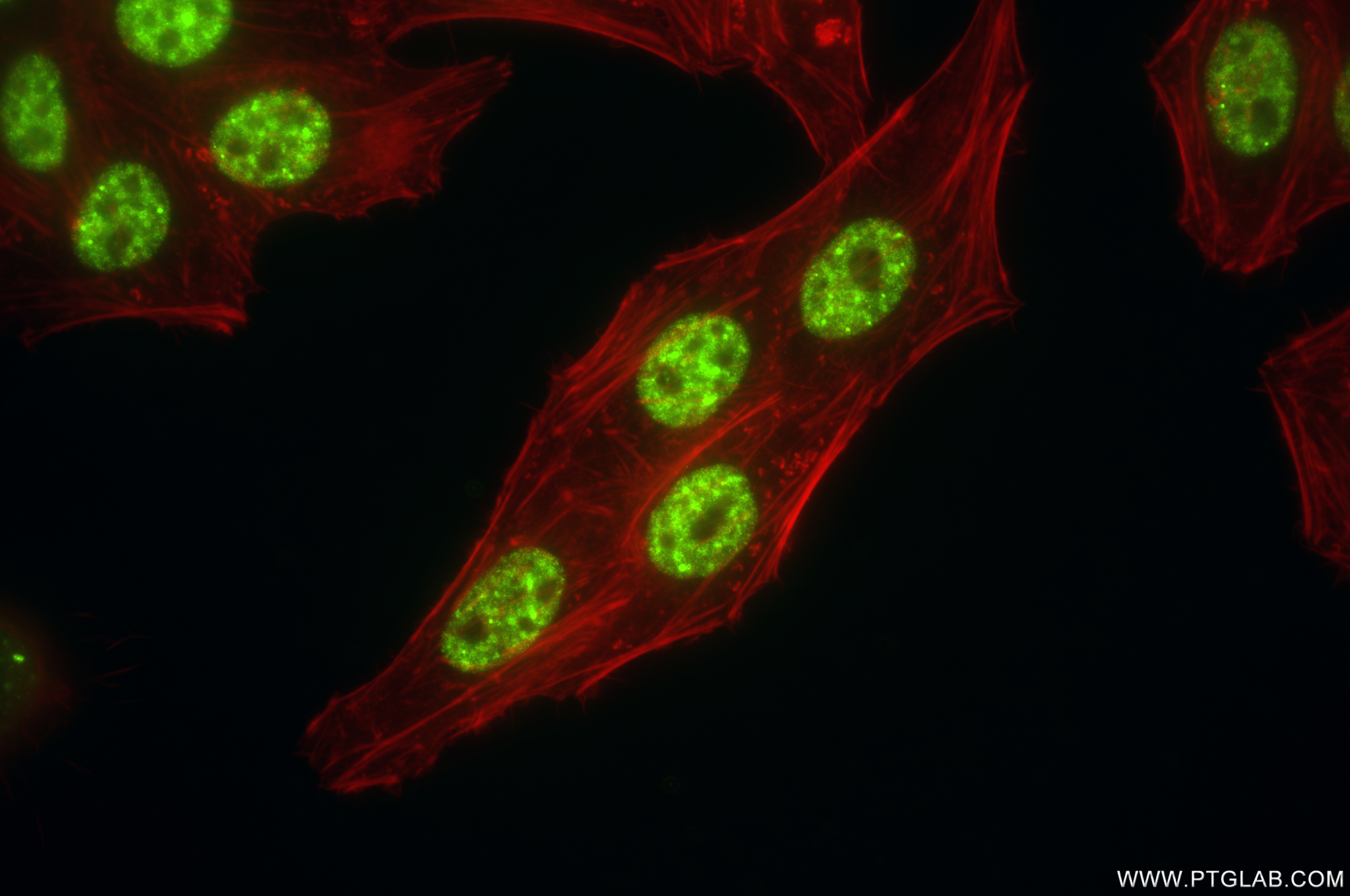 IF Staining of HepG2 using 85649-2-RR