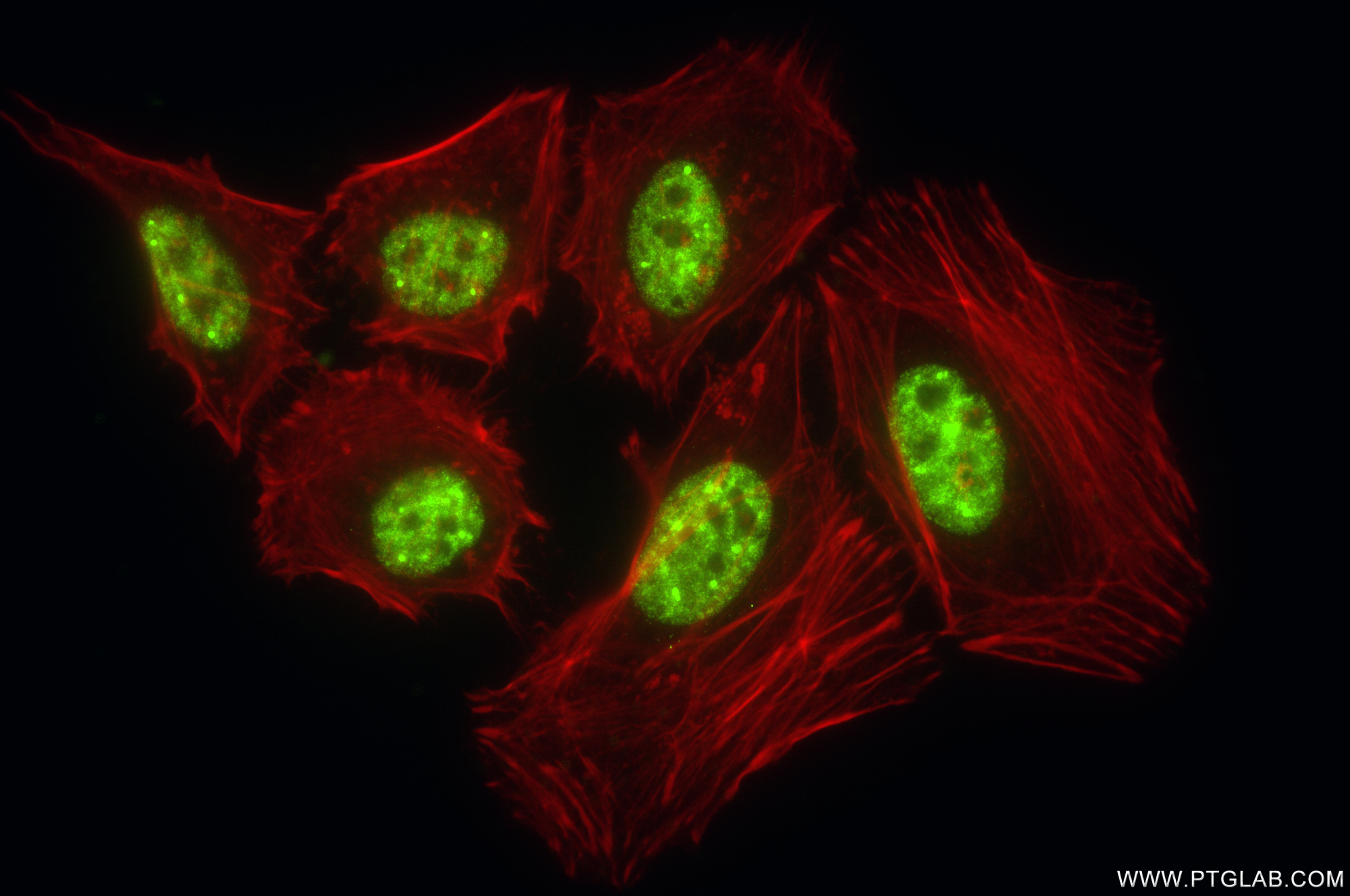 IF Staining of HeLa using 85649-2-RR