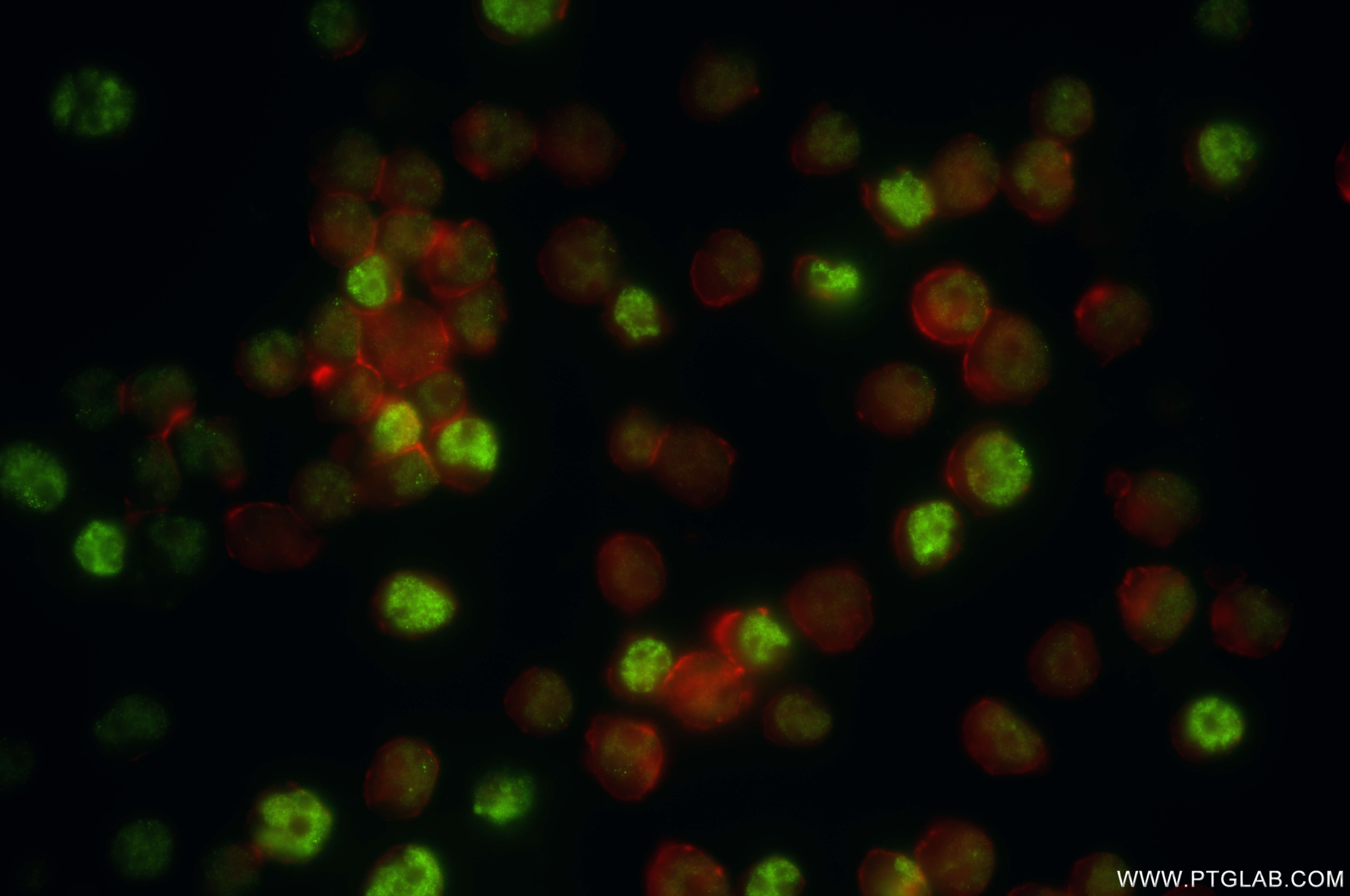 IF Staining of Jurkat using 86099-1-RR