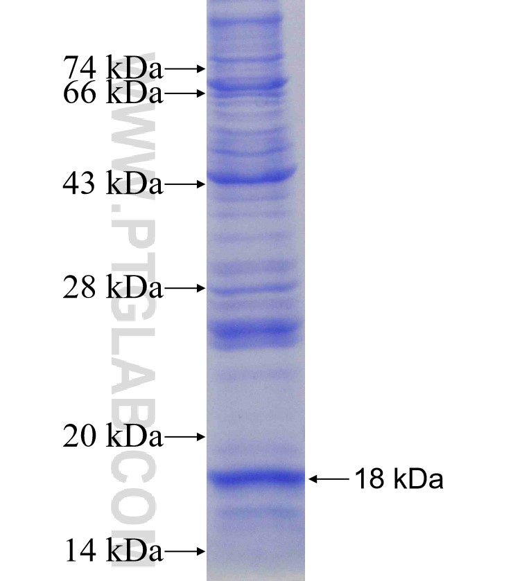 SNRPD1 fusion protein Ag16331 SDS-PAGE SNRPD1 fusion protein Ag16331 SDS-PAGE