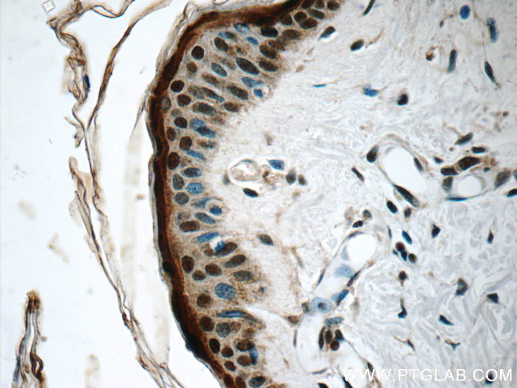 IHC staining of human skin using 14789-1-AP